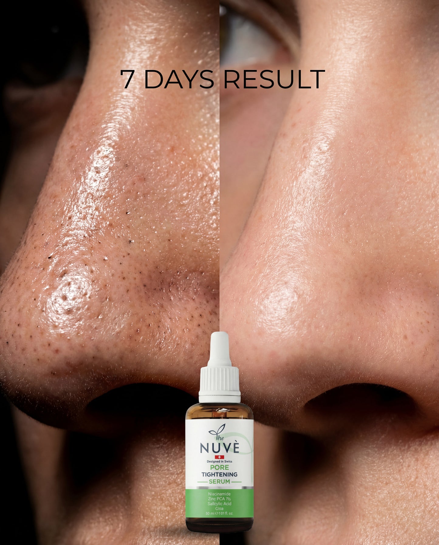 Gözenek Sıkılaştırıcı ve Sebum Dengeleyici Serum