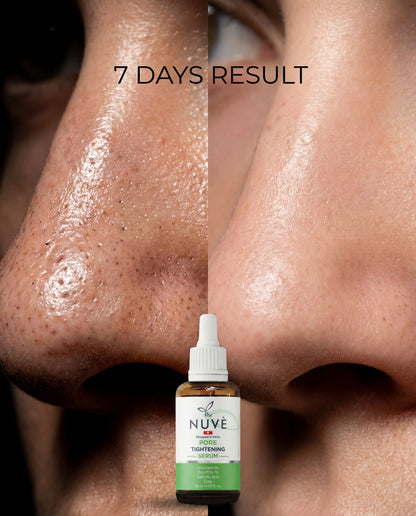Gözenek Sıkılaştırıcı ve Sebum Dengeleyici Serum